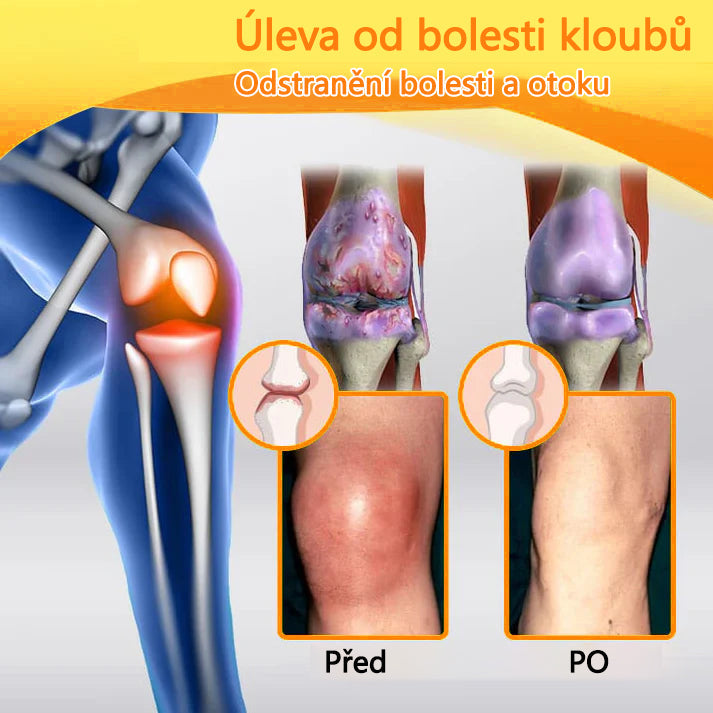 🐝🐝 TLOPA® Krém s botulotoxinem a včelím jedem (Speciálně pro seniory & doporučeno ortopedickými specialisty) 🌿