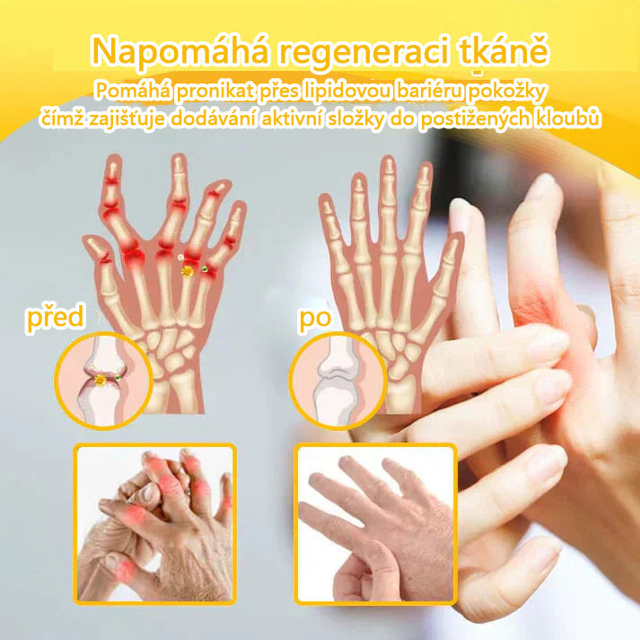 🐝🐝 TLOPA® Krém s botulotoxinem a včelím jedem (Speciálně pro seniory & doporučeno ortopedickými specialisty) 🌿