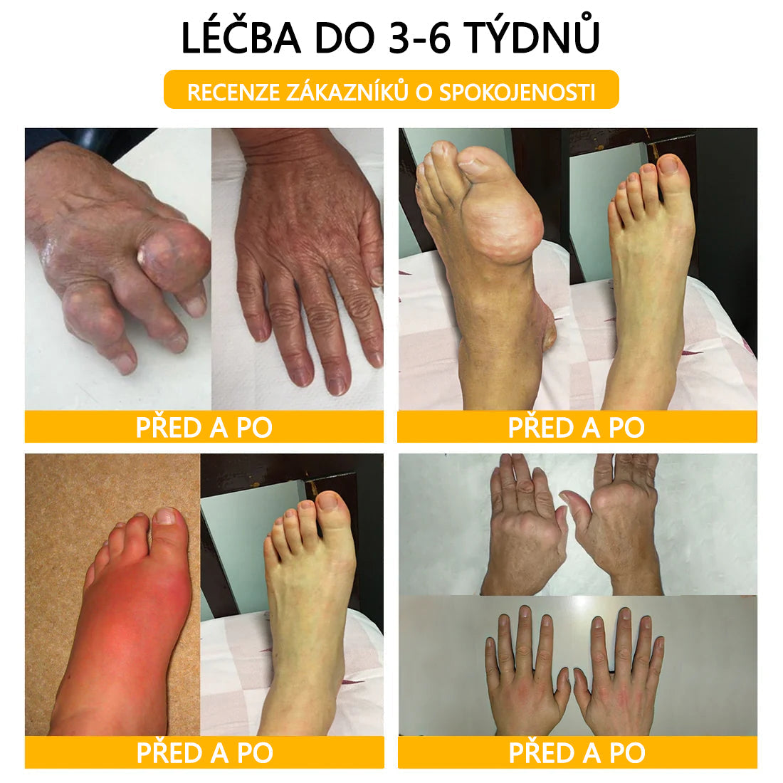 🐝🐝 TLOPA® Krém s botulotoxinem a včelím jedem (Speciálně pro seniory & doporučeno ortopedickými specialisty) 🌿