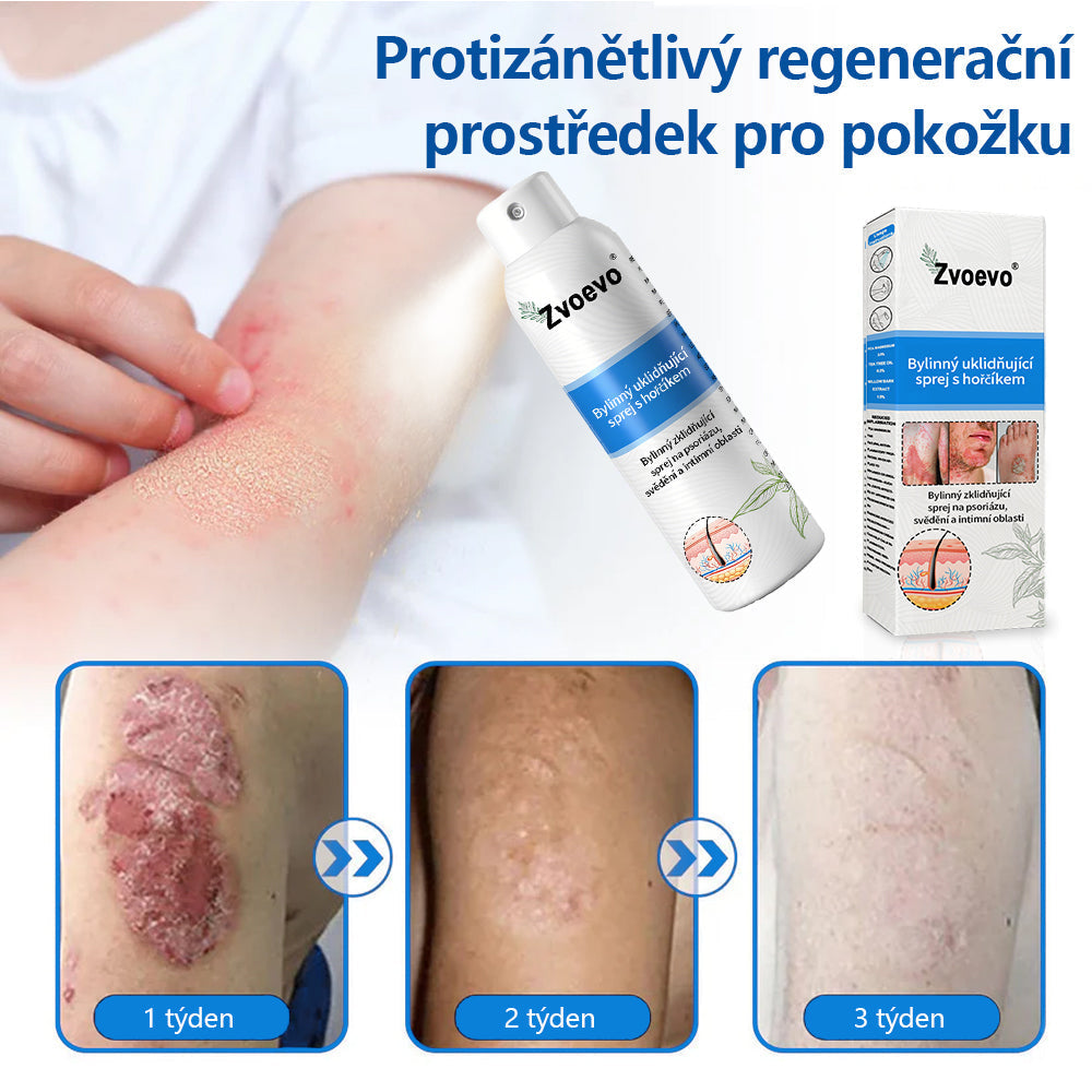 ✅ Oficiální obchod: Zvoevo® Magnesium bylinný sprej na lupénku ⚕️ EMA certifikace (zmírňuje lupénku a ekzém, léčí akné a bradavice, podporuje hojení bakteriálních infekcí, snižuje kloubní a neuropatickou bolest) 🌿