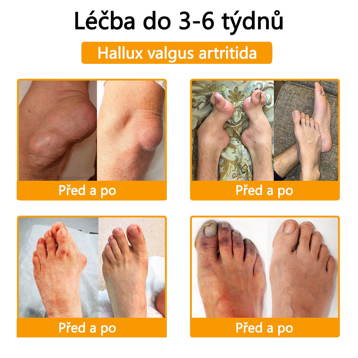 🐝🐝 TLOPA® Krém s botulotoxinem a včelím jedem (Speciálně pro seniory & doporučeno ortopedickými specialisty) 🌿