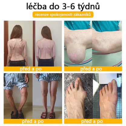 🐝🐝 TLOPA® Krém s botulotoxinem a včelím jedem (Speciálně pro seniory & doporučeno ortopedickými specialisty)  🌿