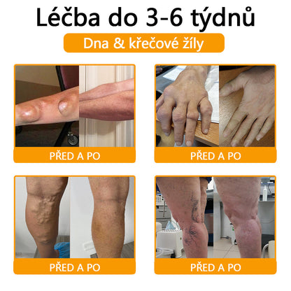 🐝🐝 TLOPA® Krém s botulotoxinem a včelím jedem (Speciálně pro seniory & doporučeno ortopedickými specialisty)  🌿