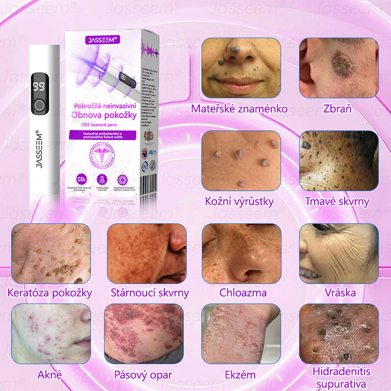 🌿𝐉𝐚𝐬𝐬𝐞𝐞𝐦® Pokročilé neinvazivní pero s CO₂ laserem na opravu pokožky 💕 (šetrně odstraňuje bradavice, mateřská znaménka, stařecké skvrny a kožní značky - bez bolesti a rozruchu!) 🔥