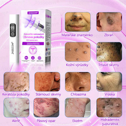 🌿𝐉𝐚𝐬𝐬𝐞𝐞𝐦® Pokročilé neinvazivní pero s CO₂ laserem na opravu pokožky 💕 (šetrně odstraňuje bradavice, mateřská znaménka, stařecké skvrny a kožní značky - bez bolesti a rozruchu!) 🔥