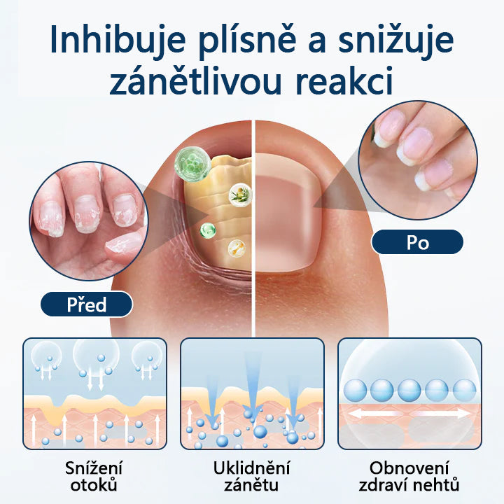 🔥Bylinný sprej proti plísním Timilk® OnyxiGuard