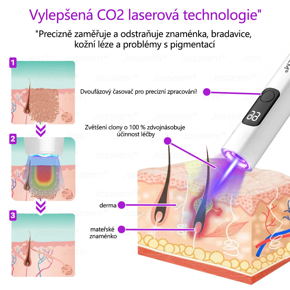 🌿𝐉𝐚𝐬𝐬𝐞𝐞𝐦® Pokročilé neinvazivní pero s CO₂ laserem na opravu pokožky 💕 (šetrně odstraňuje bradavice, mateřská znaménka, stařecké skvrny a kožní značky - bez bolesti a rozruchu!) 🔥