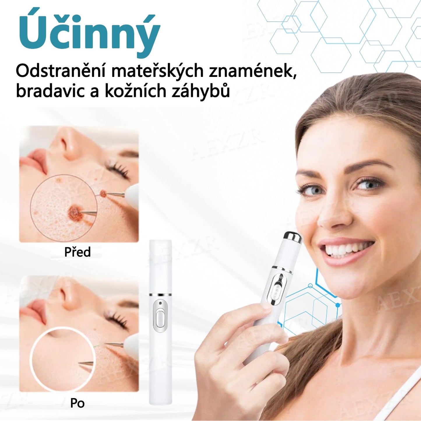 Foulme® PRO Neinvazivní laserové pero na odstraňování bradavic a znamének 🛒