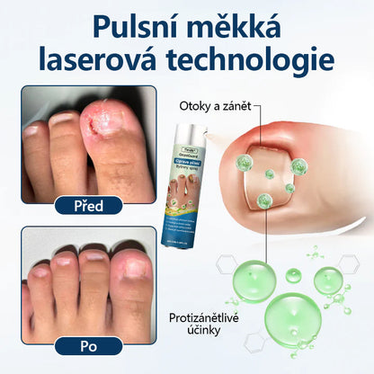 🔥Bylinný sprej proti plísním Timilk® OnyxiGuard