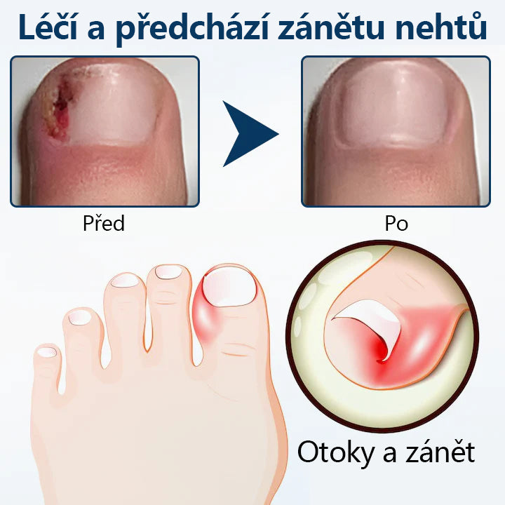 🔥Bylinný sprej proti plísním Timilk® OnyxiGuard