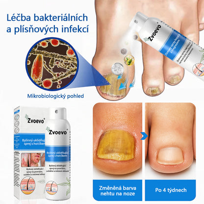 ✅ Oficiální obchod: Zvoevo® Magnesium bylinný sprej na lupénku ⚕️ EMA certifikace (zmírňuje lupénku a ekzém, léčí akné a bradavice, podporuje hojení bakteriálních infekcí, snižuje kloubní a neuropatickou bolest)  🛒