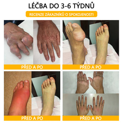 🐝🐝 TLOPA® Krém s botulotoxinem a včelím jedem (Speciálně pro seniory & doporučeno ortopedickými specialisty)  🌿