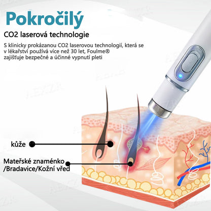 Foulme® PRO Neinvazivní laserové pero na odstraňování bradavic a znamének 🛒