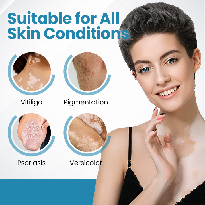 Zařízení Bikenda® DermaBeam pro terapii vitiliga💥