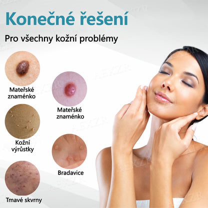 Foulme® PRO Neinvazivní laserové pero na odstraňování bradavic a znamének 🛒