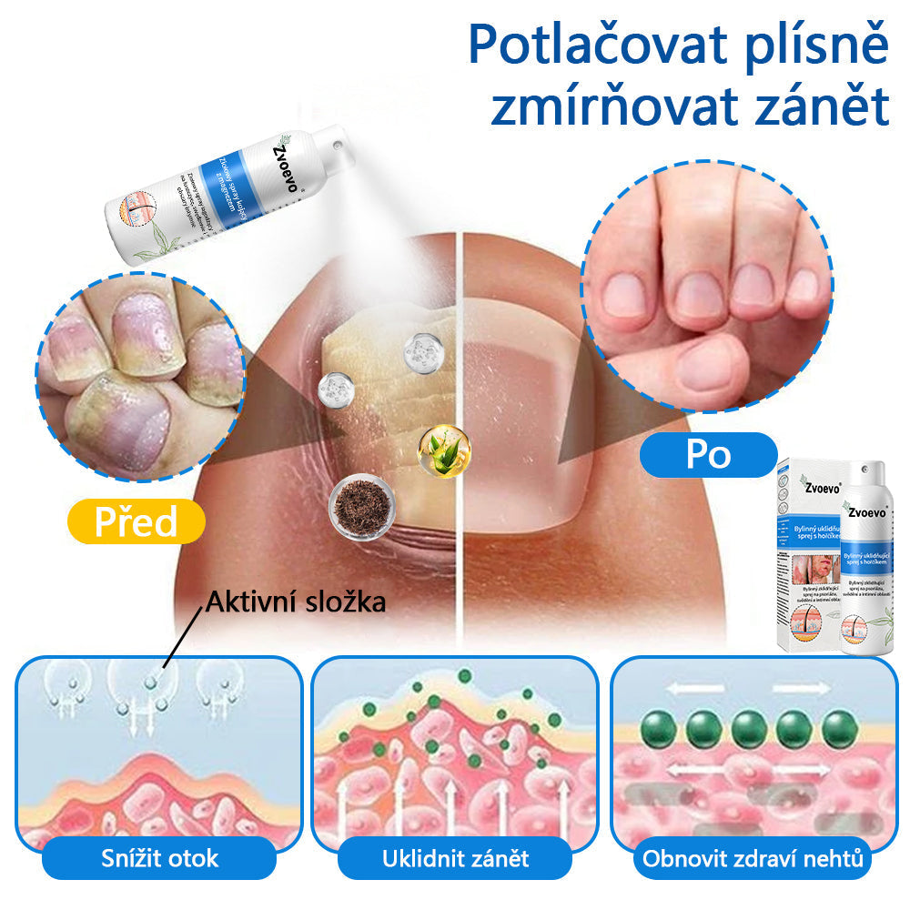 ✅ Oficiální obchod: Zvoevo® Magnesium bylinný sprej na lupénku ⚕️ EMA certifikace (zmírňuje lupénku a ekzém, léčí akné a bradavice, podporuje hojení bakteriálních infekcí, snižuje kloubní a neuropatickou bolest)  🛒